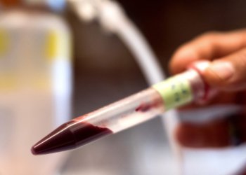 خوینا دەستكرد یا مرۆڤان هاتە چێكرن