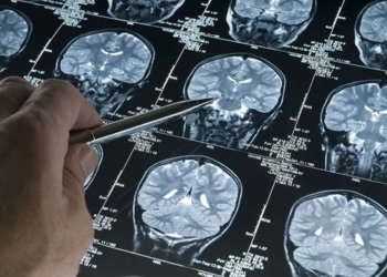 ڤه‌كۆله‌رێن بریتانیا ده‌رمانه‌كێ نوو بۆ چاره‌سه‌رییا زه‌هایمه‌رێ دیت