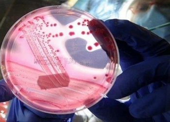 وەزارەتا چاندنێ شەش خال وەکو ڕێکارێن بەرهەنگاربوونا تایا خوینبەربوونێ بەلاڤکرن